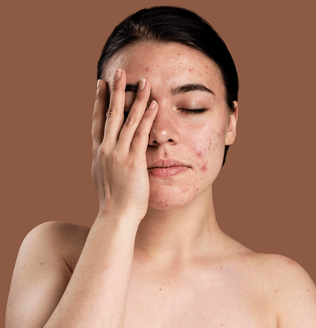 Pigmentation-main-Image
